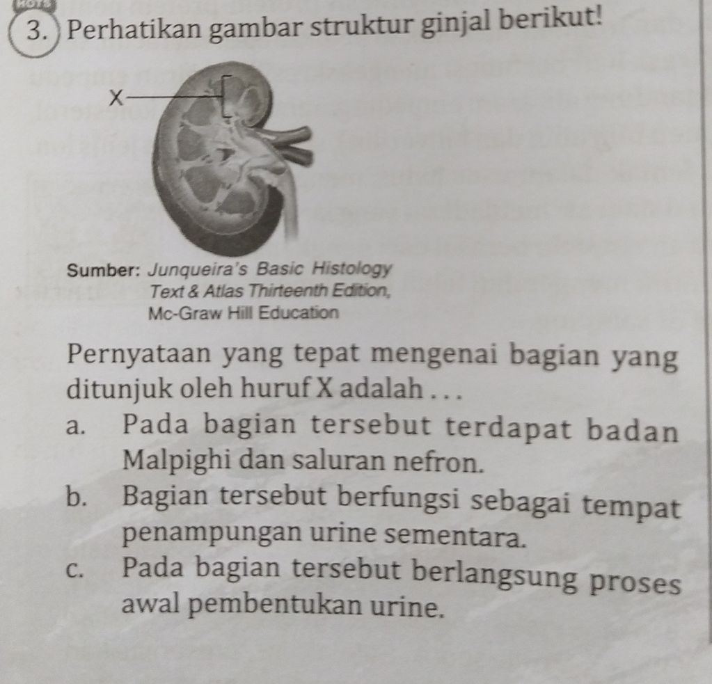 Perhatikan Gambar Struktur Ginjal Berikut! Pernyat...