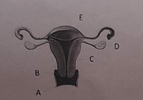 Perhatikan Gambar Berikut! Berdasarkan Gambar Di ...