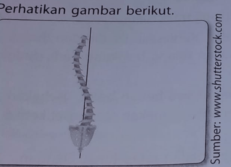 Perhatikan Gambar Berikut. B. Apa Saja Penyebab Ke...