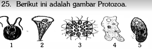 Di antara Protozoa tersebut yang termasuk kelompok...